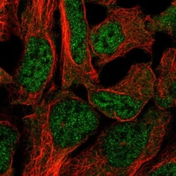 DAAM2 Antibody, Novus Biologicals 25 &mu;L; Unlabeled:Antibodies, Polyclonal
